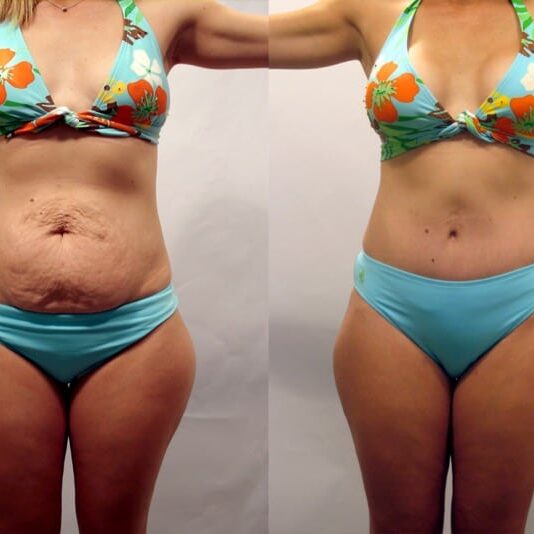 Insivo - Plastic Surgery